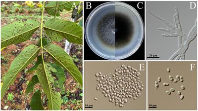 Biological characterization and in vitro fungicide screening of a new causal agent of walnut leaf spot in Guizhou Province, China